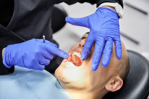 Best Emergency Denture Repair in Beloit, WI
